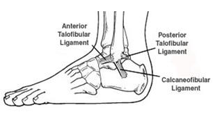 ankle-sprain